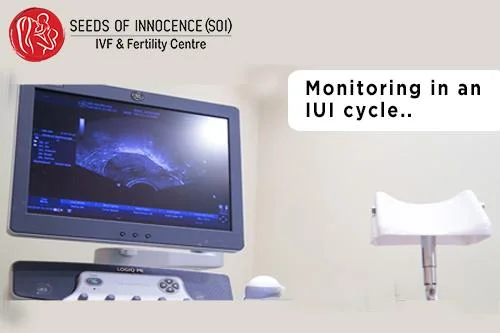 Monitoring in an IUI Cycle